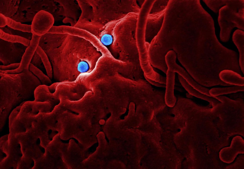CDC image of coronavirus